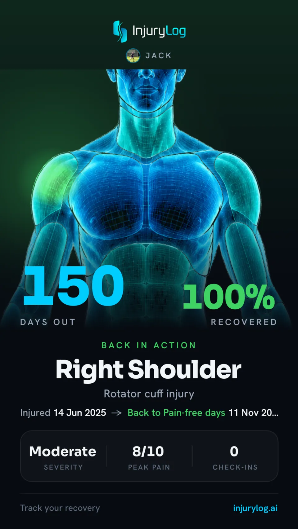 Back in action card: right shoulder rotator cuff, 150 days out, 100% recovered, injured 14 June 2025.