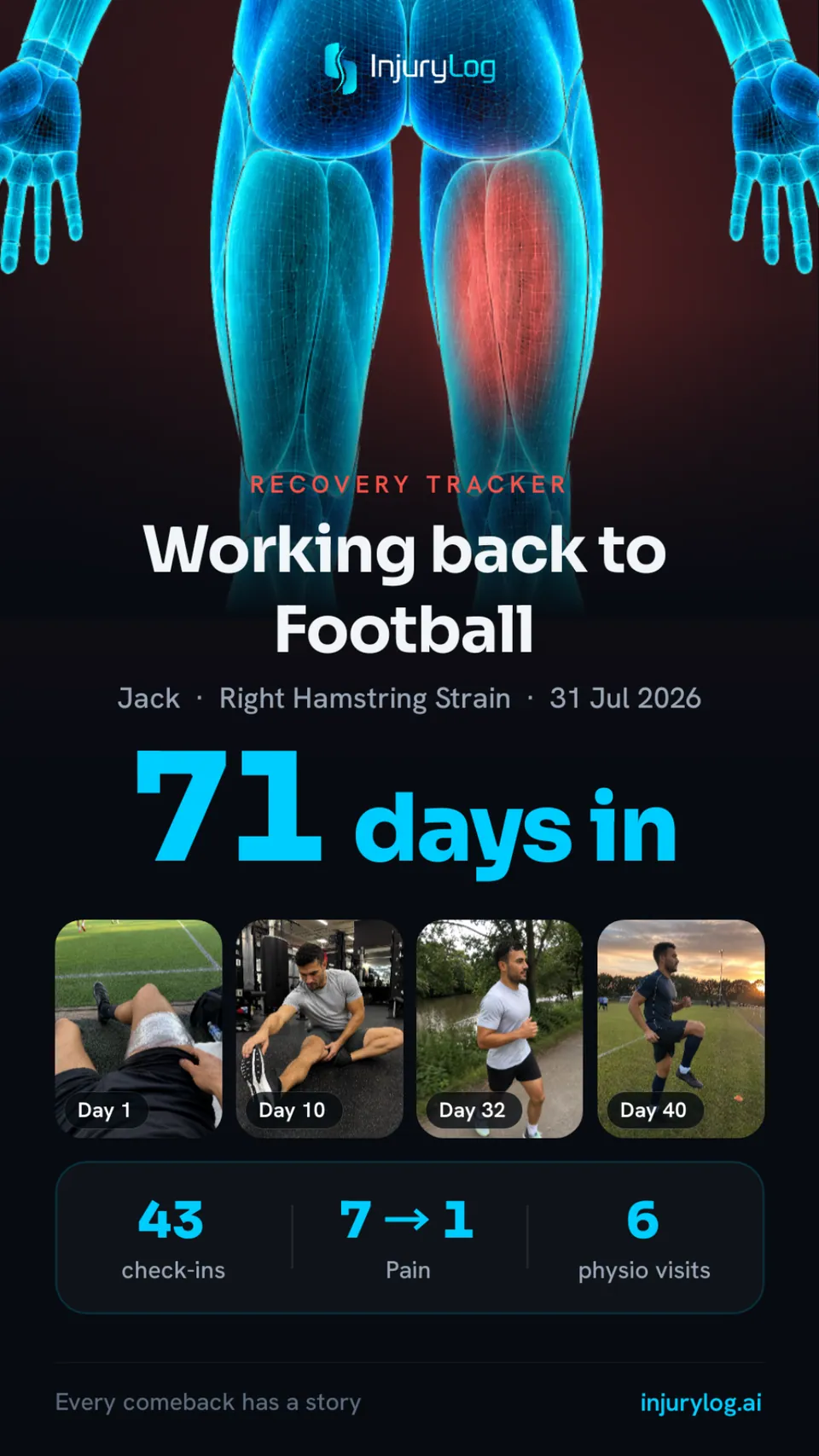 Working back to football card with the hologram of both hamstrings, the right one lit, 71 days in.