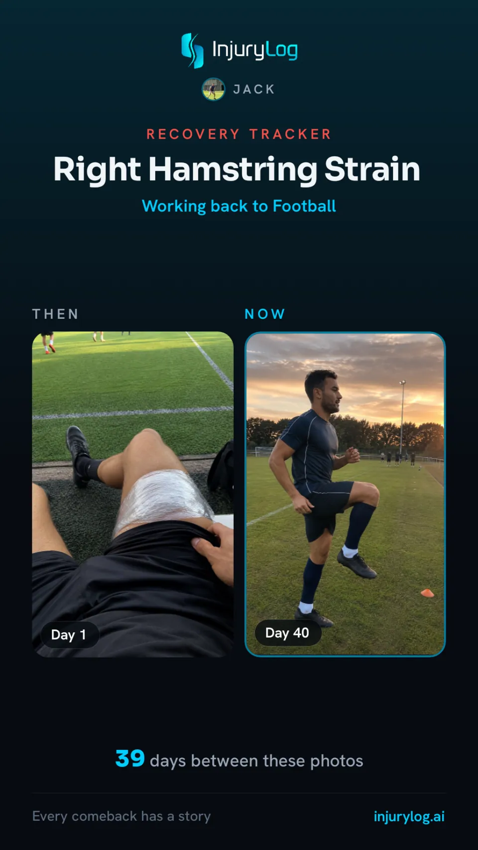 Recovery tracker card: right hamstring strain, working back to football, a then and now photo pair 39 days apart.