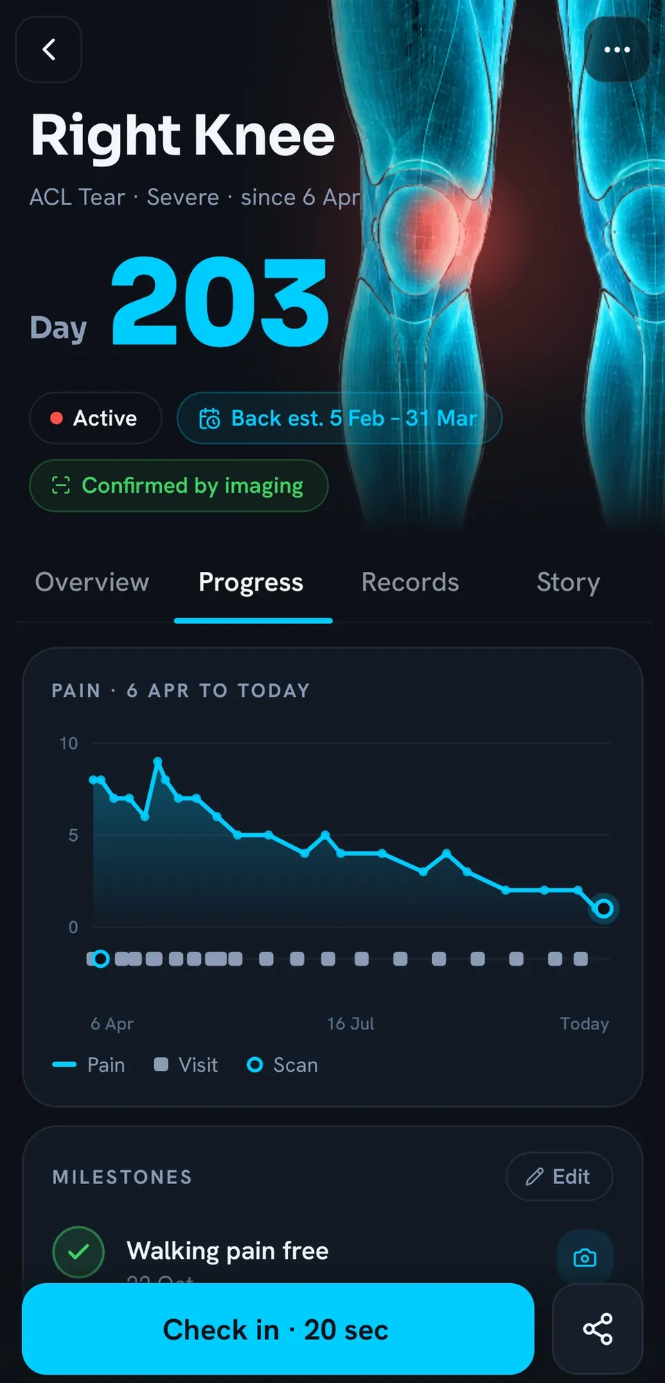 Progress for the right knee from 6 April to today: the pain line falling from about 8 to 1, with every physio visit and scan marked along the timeline, and the first milestone, walking pain free, ticked off.