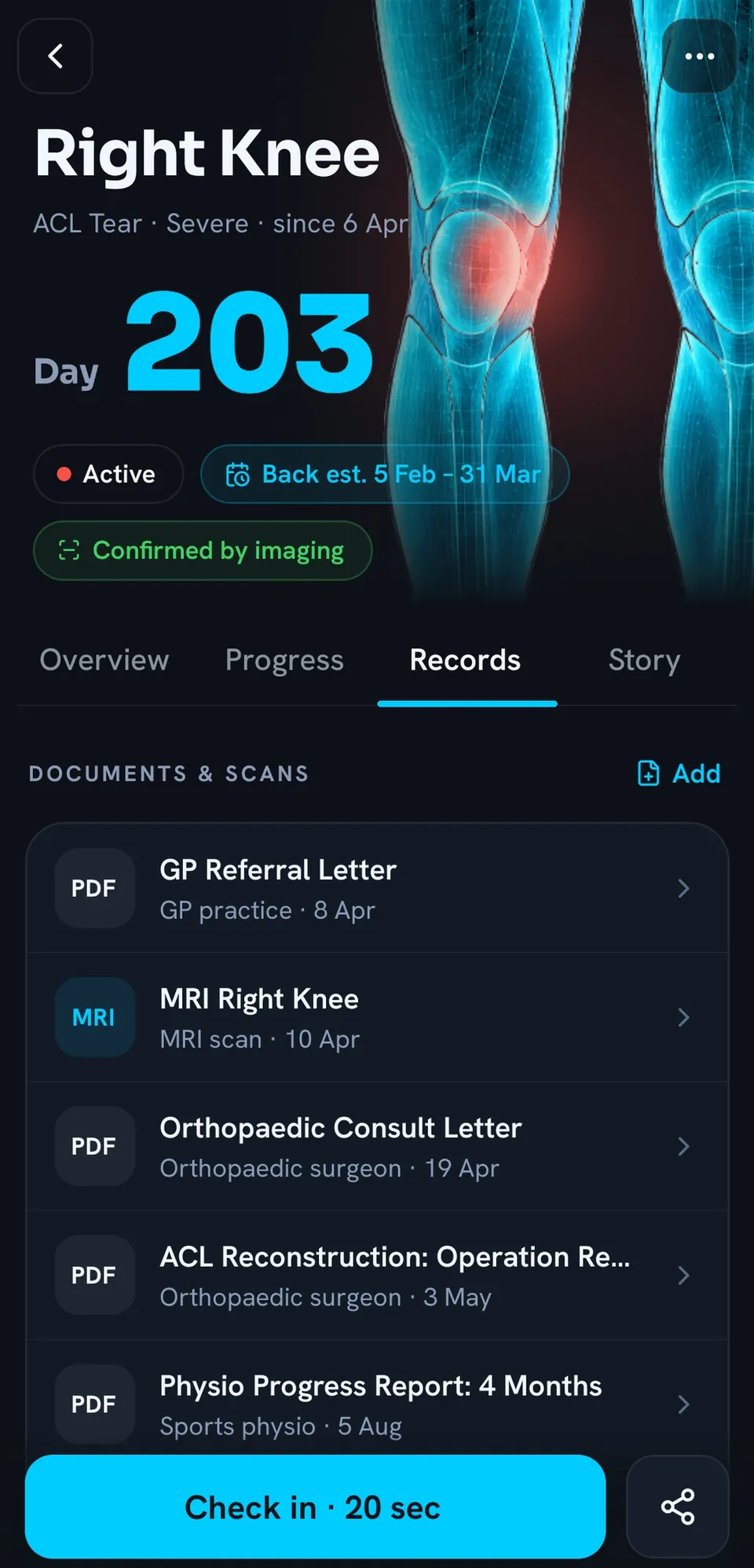 Documents and scans for the right knee: GP referral letter, MRI of the right knee, orthopaedic consult letter, ACL reconstruction operation report and a 4-month physio progress report.