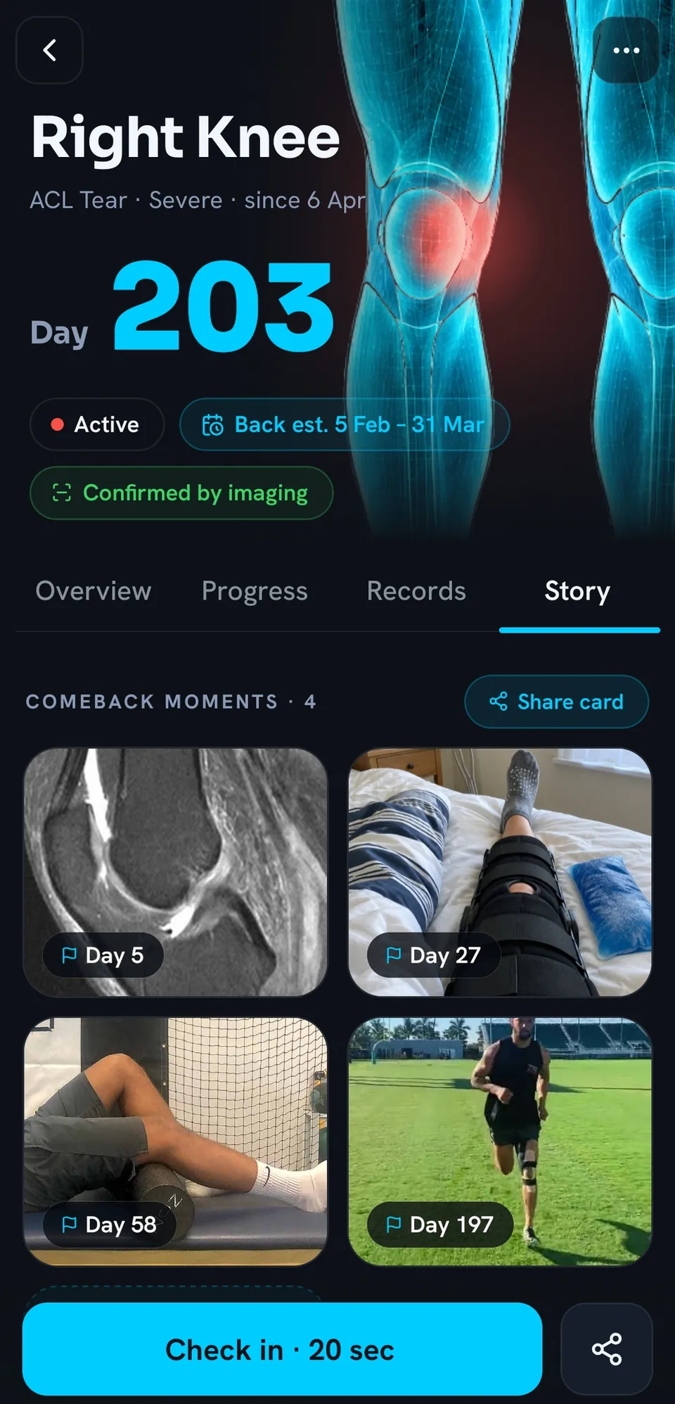 Comeback moments for an ACL recovery: the MRI on day 5, the knee in a brace on day 27, foam rolling on day 58 and the first run back on a pitch on day 197.