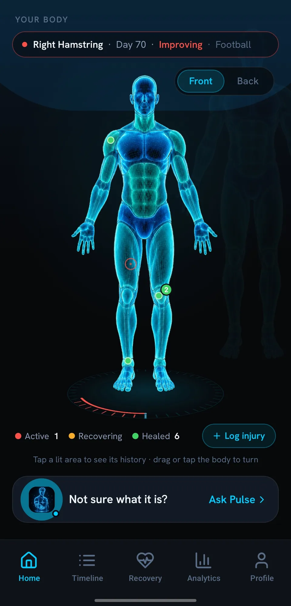 InjuryLog body map: front and back hologram with the active right hamstring in red and healed injuries in green.