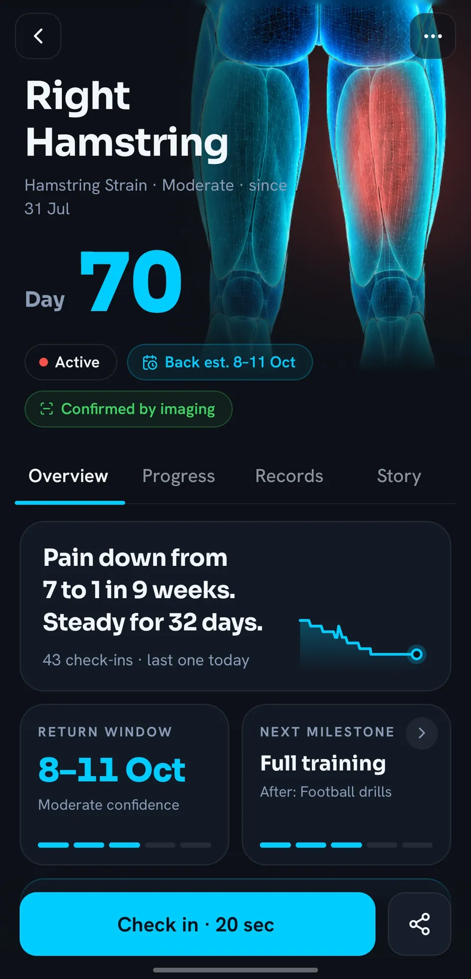 Right hamstring injury file: hamstring strain, moderate, since 31 July, day 70, back estimate 8 to 11 October, confirmed by imaging.