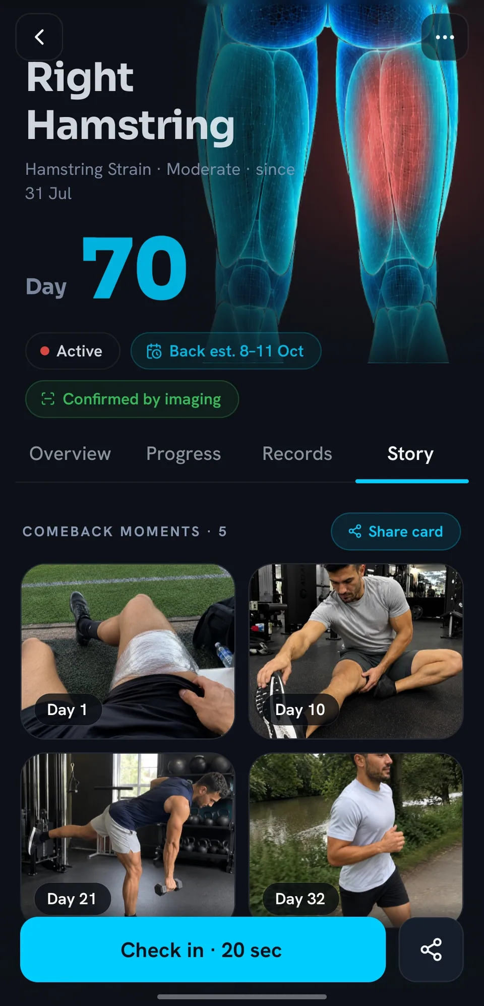 Right hamstring story: comeback photos from day 1, day 10, day 21 and day 32.
