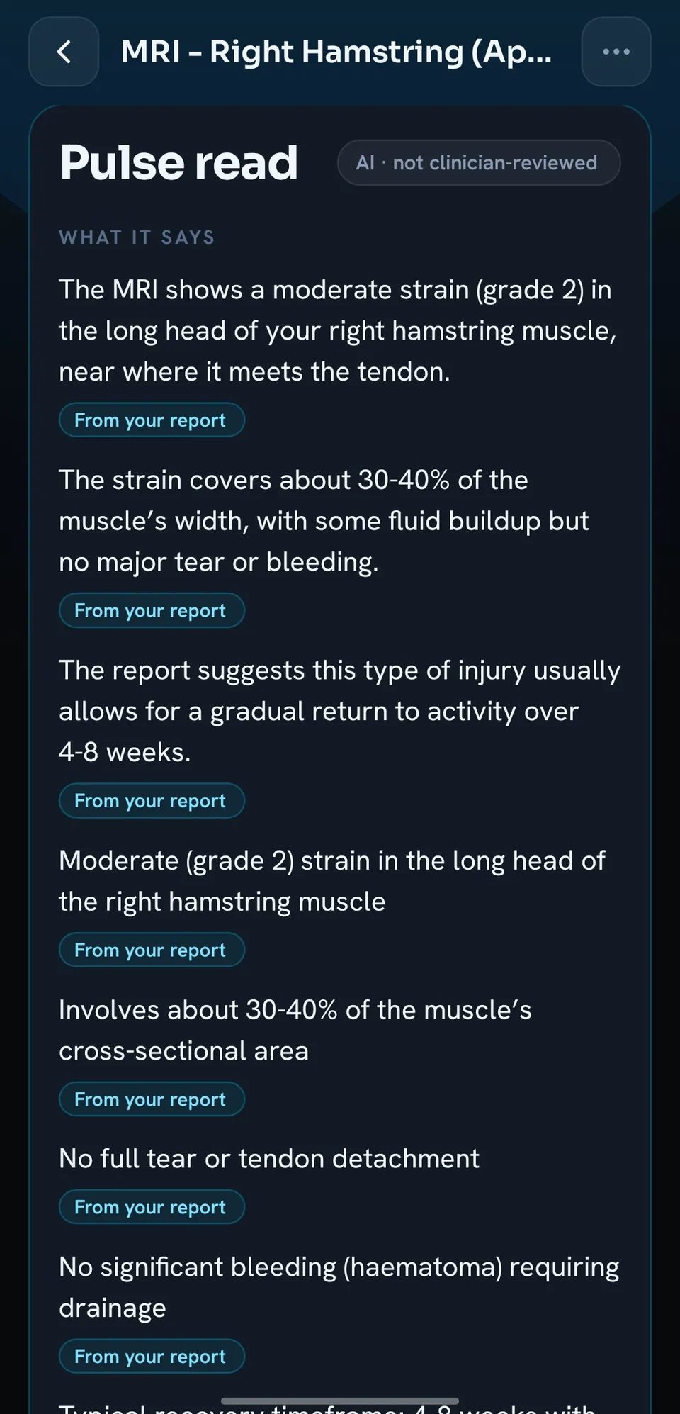 Pulse read of an MRI report in plain English: what it says, from your report. Educational, not medical advice.
