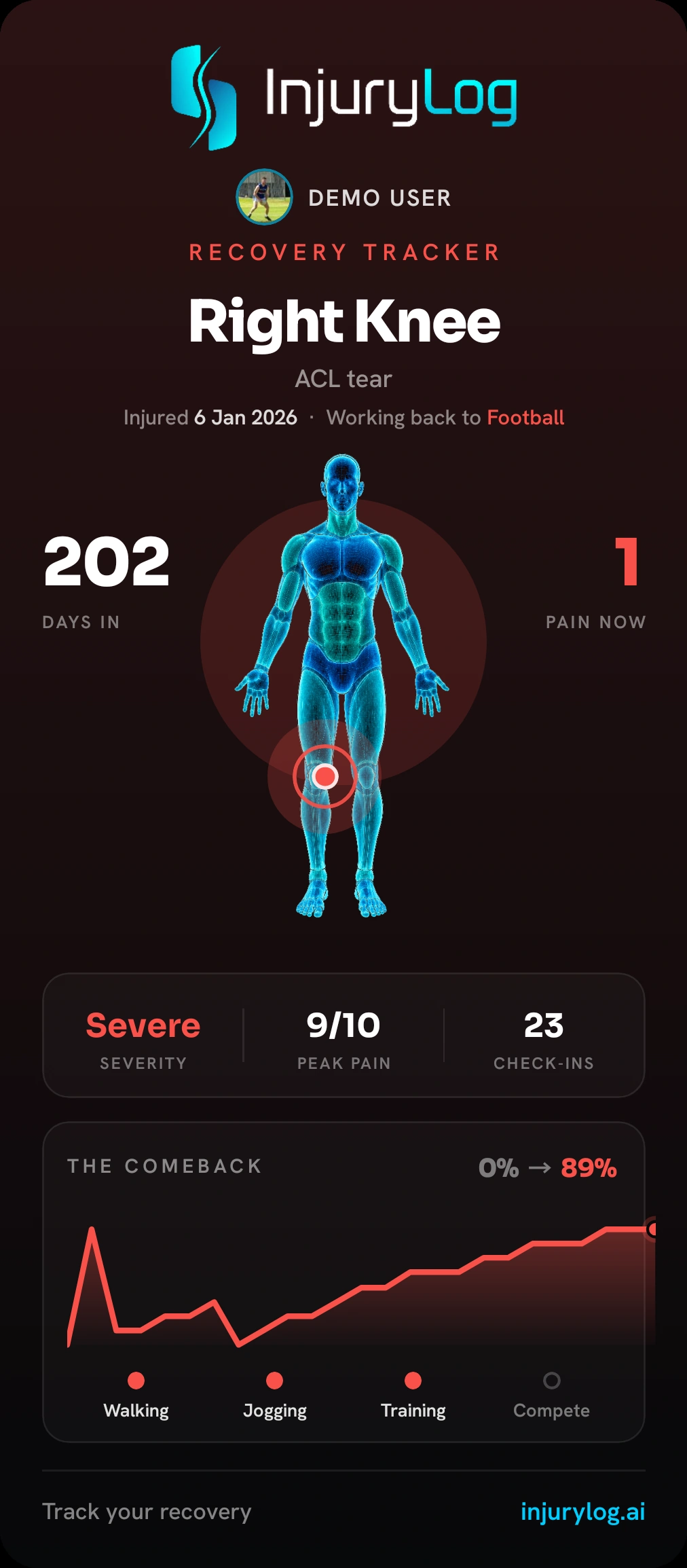 InjuryLog recovery tracker card: right knee ACL tear, day 202, comeback from 0 to 89 percent