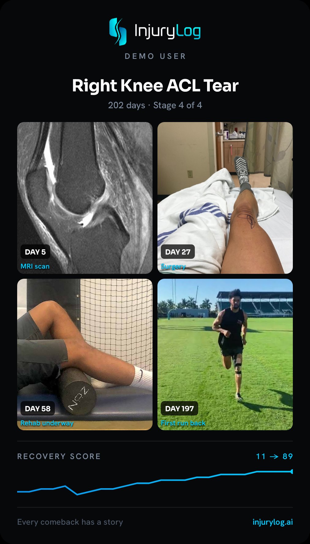 InjuryLog comeback story: MRI, surgery, rehab and first run back in photos, recovery score 11 to 89